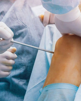 Sports Injury & Arthroscopy in Mumbai